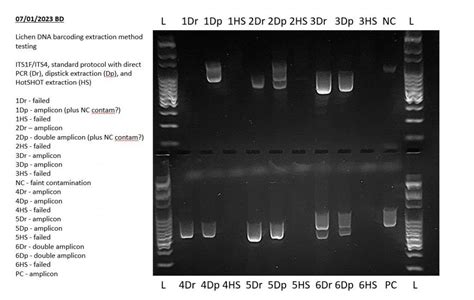 interpreting gel electrophoresis results|Gel electrophoresis (article) .